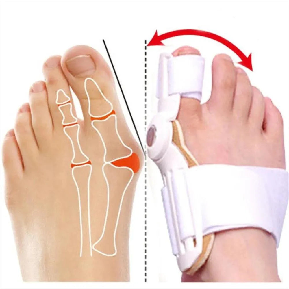 Férula Correctora para Juanetes | Alivio, Soporte y Alineación para el Dedo Gordo del Pie 🦶✨💙
